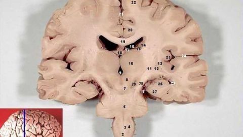 Researchers Show Human Learning Altered by Electrical Stimulation of Dopamine Neurons Researchers Show Human Learning Altered by Electrical Stimulation of Dopamine Neurons