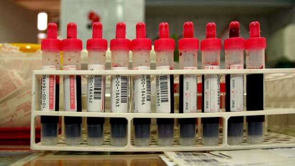 Early Alzheimer’s Blood Test Co-Developer to Discuss How the Test Could Be the First Step in Developing Treatments to Halt or Slow Alzheimer’s at 2014 AACC Annual Meeting content piece image