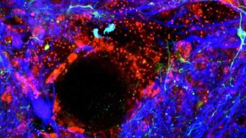 Why inflammation leads to a leaky blood-brain barrier: MicroRNA-155