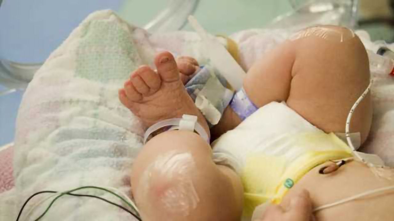 Antipsychotic medication during pregnancy does affect babies, study shows