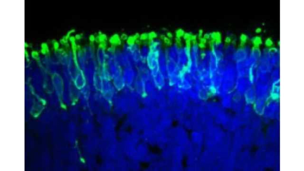 Human Stem Cells Used to Create Light-Sensitive Retina in a Dish
