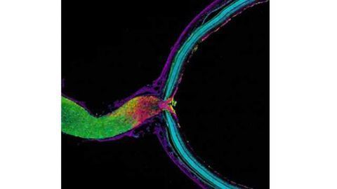 Getting rid of old mitochondria: Some neurons turn to neighbors to help take out the trash
