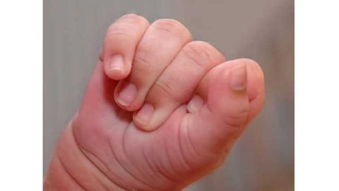 Limited motor skills in early infancy may be trait of autism