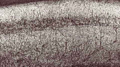 Self-repairing mechanism can help to preserve brain function in neurodegenerative diseases