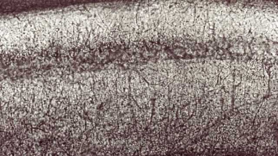 Self-repairing mechanism can help to preserve brain function in neurodegenerative diseases content piece image