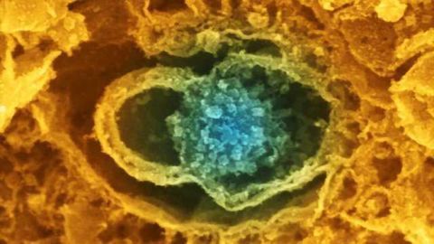 Researchers discover that synaptic levels of clathrin protein are important for neuronal plasticity