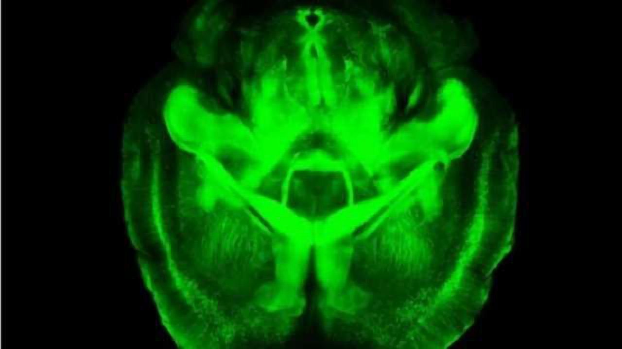 Seeing the inner workings of the brain made easier by new technique