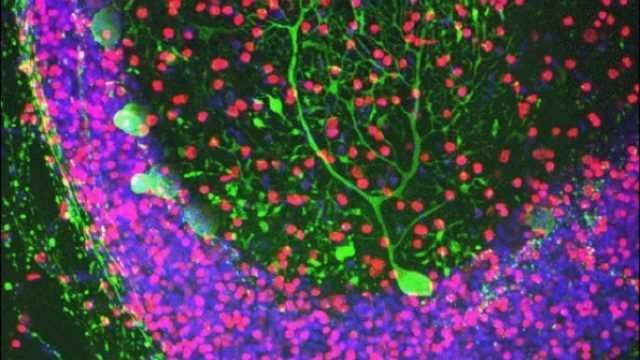 Researchers find gene critical for development of brain motor centre content piece image 