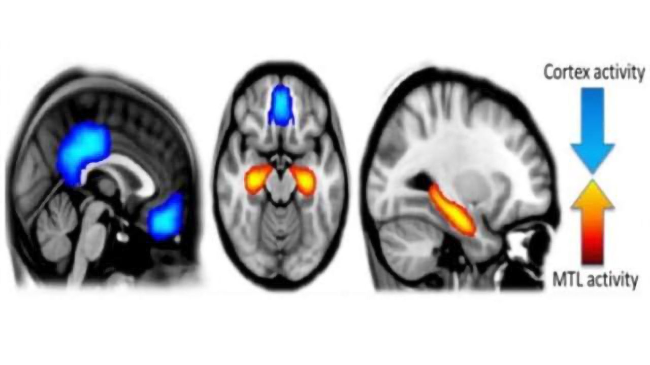 New study discovers biological basis for magic mushroom 'mind expansion'