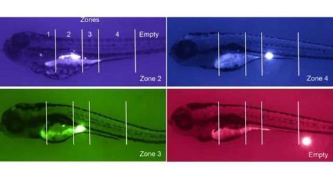 Genetic basis for distinct type of autism uncovered