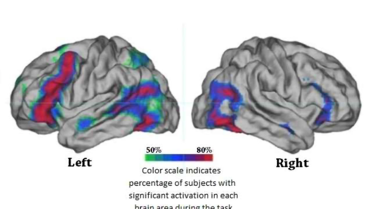 A dominant hemisphere for handedness and language?