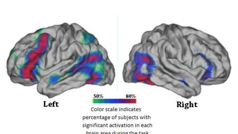 A dominant hemisphere for handedness and language?
