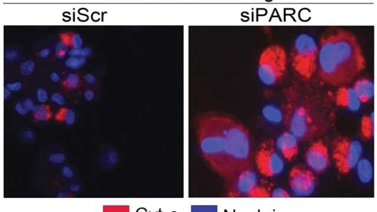 Neurons, brain cancer cells require the same little-known protein for long-term survival