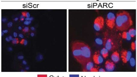 Neurons, brain cancer cells require the same little-known protein for long-term survival