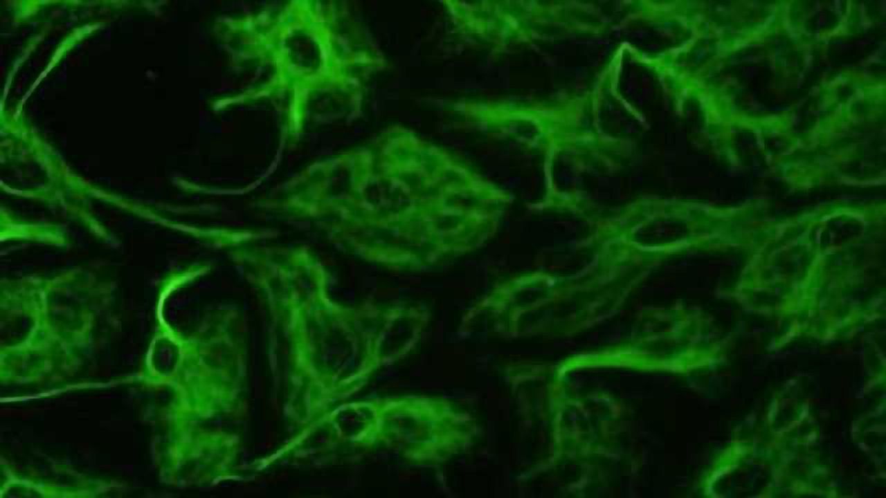 Astroglial 'support cells' in brain play important role in Down syndrome