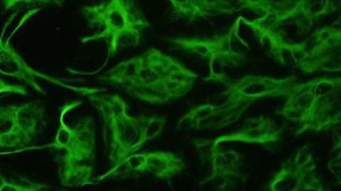 Astroglial 'support cells' in brain play important role in Down syndrome
