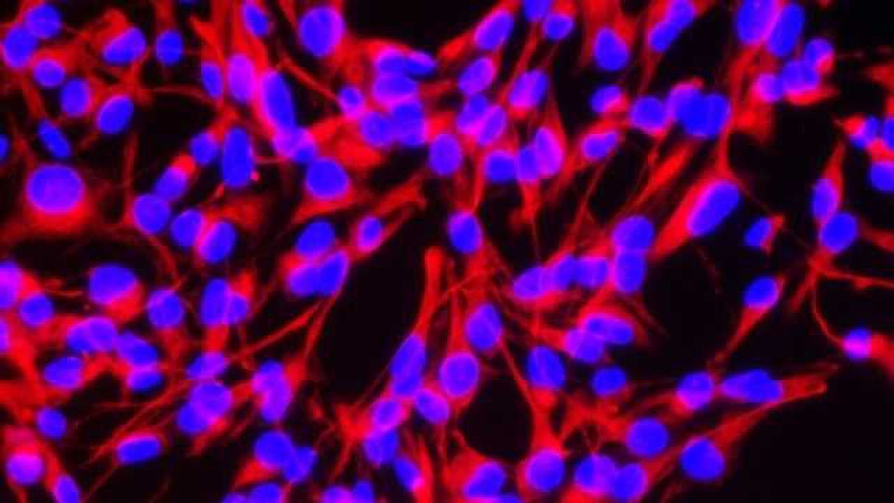 How the brain stabilizes its connections in order to learn better