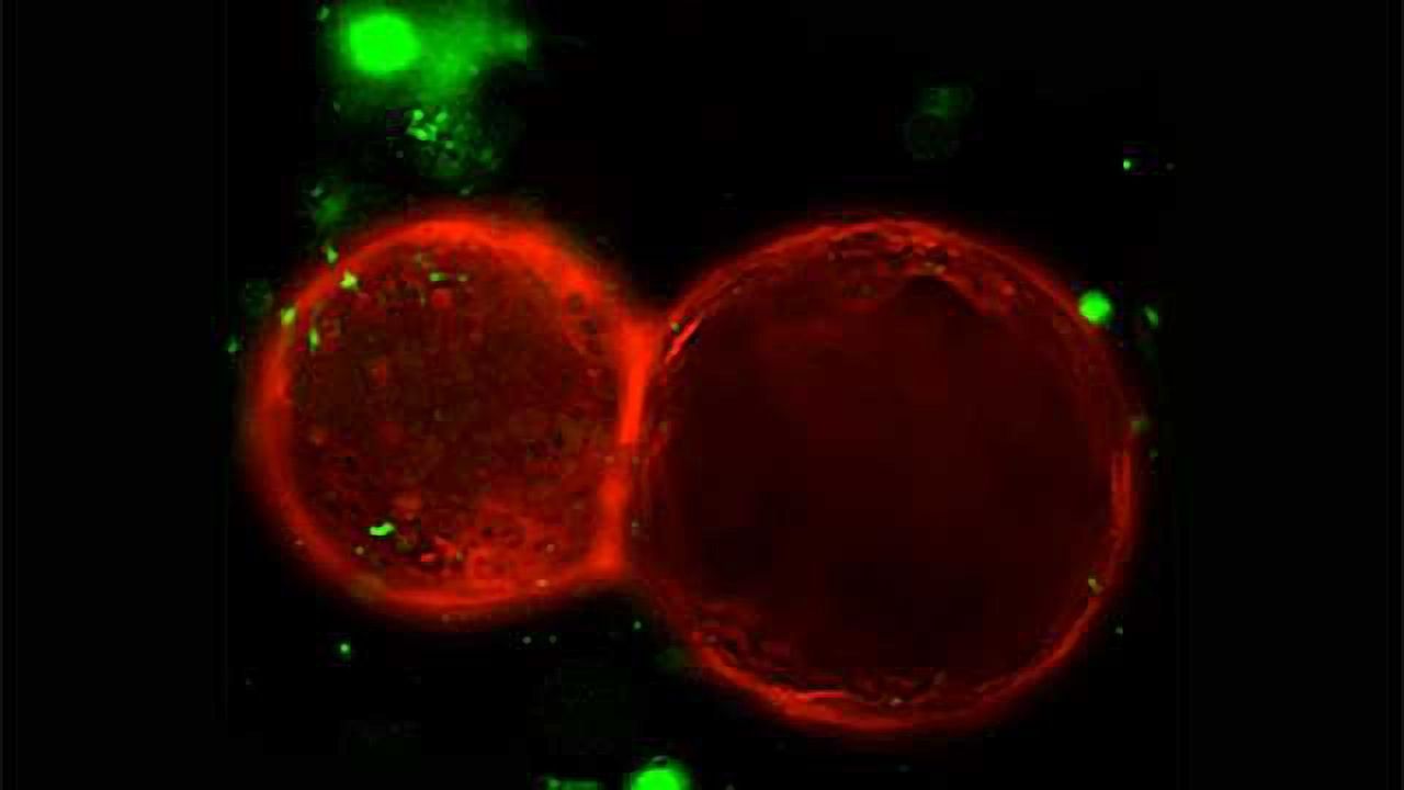 Severing nerves may shrink stomach cancers