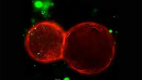 Severing nerves may shrink stomach cancers