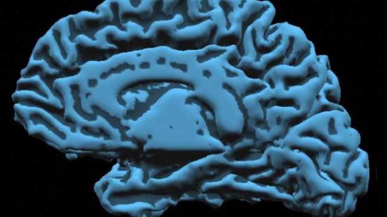 Researchers find an important clue to potential treatments for absence seizures