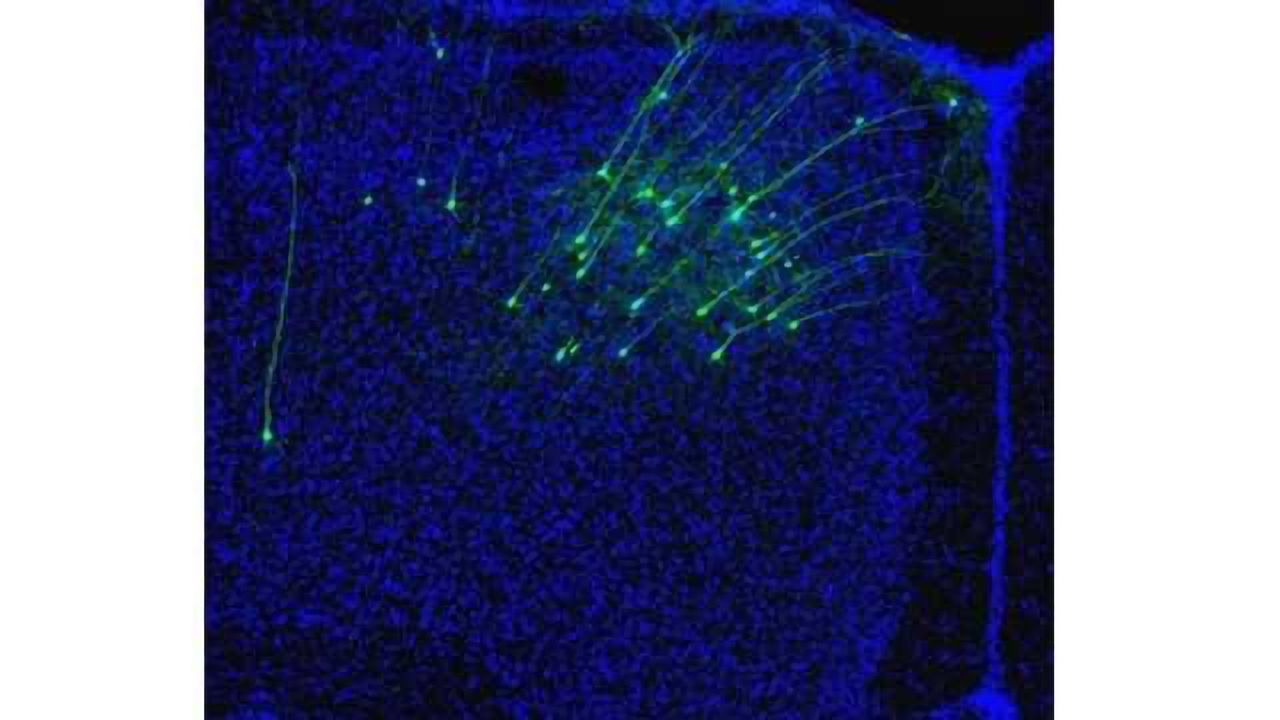 Stop and listen: Study shows how movement affects hearing