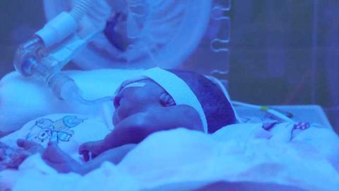 EPO: Protecting brains of very preterm infants