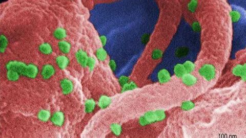 Why HIV patients develop dementia