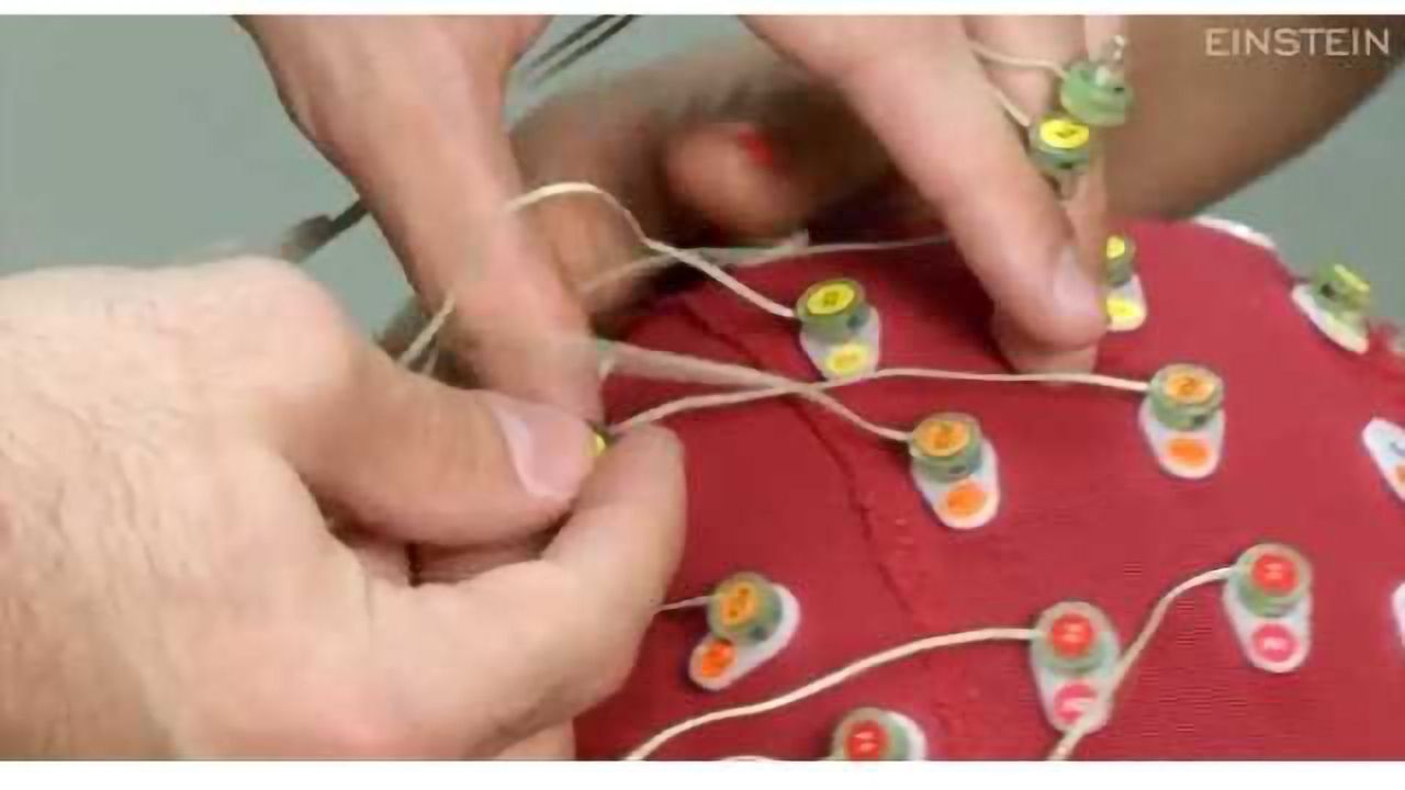Brainwave test could improve autism diagnosis and classification