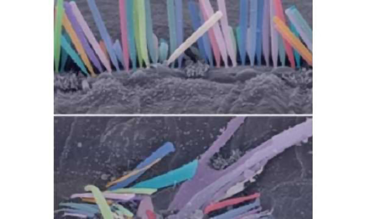 Lack of Thyroid Hormone Blocks Hearing Development