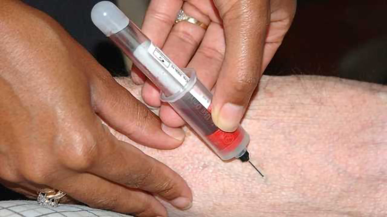 Blood test may help determine who is at risk for psychosis