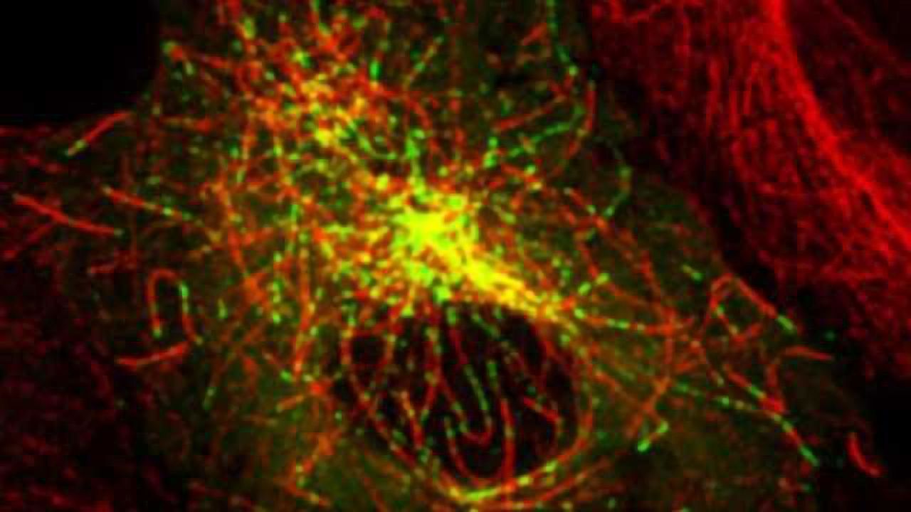 New lead for potential Parkinson’s treatment: Effects of high-risk Parkinson’s mutation are reversible