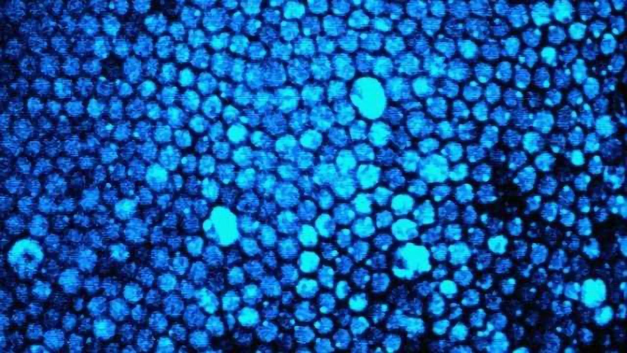 Discovery of a new mechanism that can lead to blindness