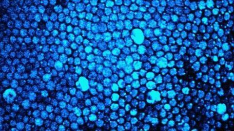 Discovery of a new mechanism that can lead to blindness