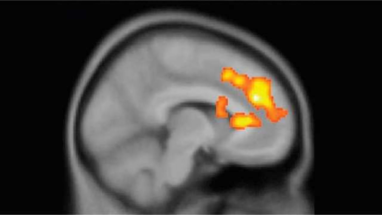 Rapid agent restores pleasure-seeking ahead of other antidepressant action