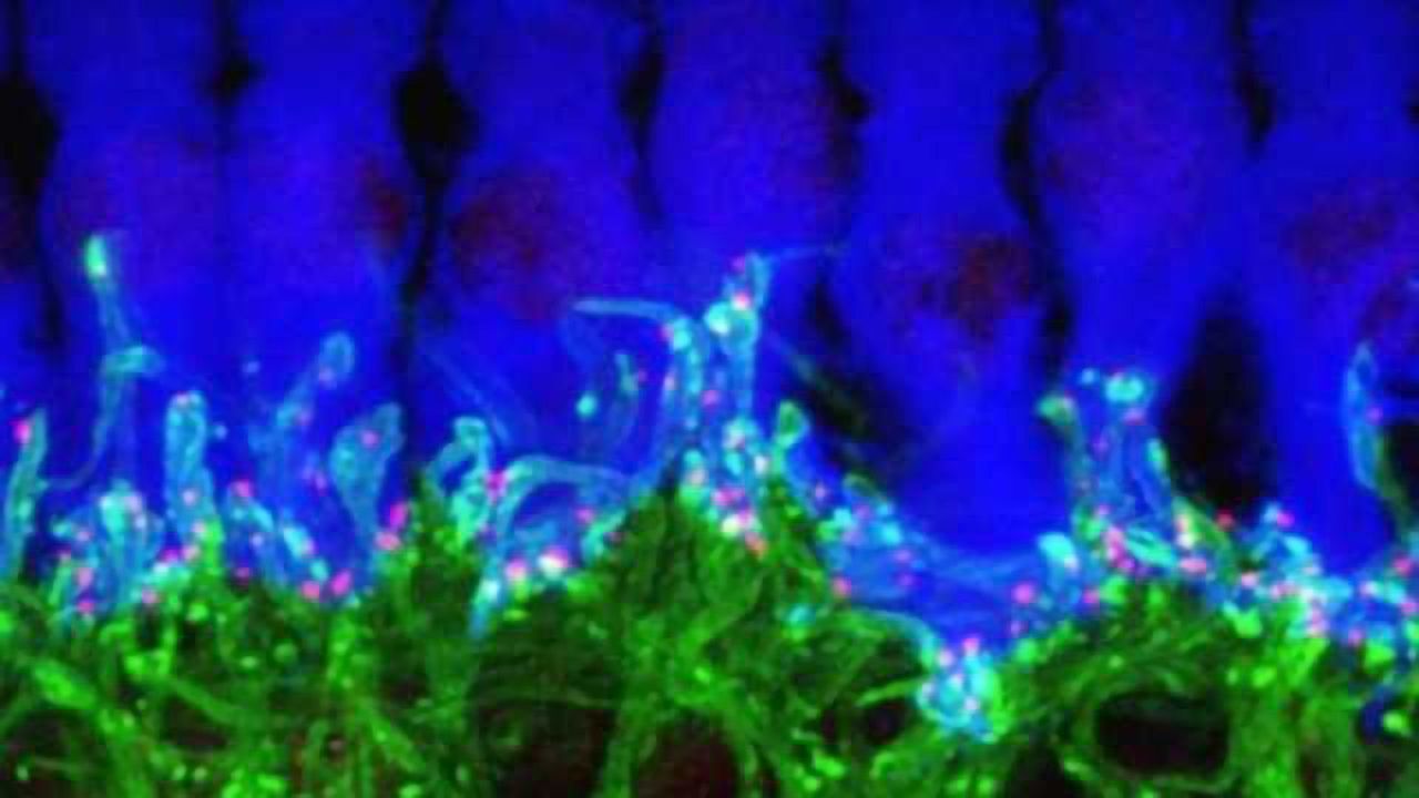 Scientists restore hearing in noise-deafened mice, pointing way to new therapies