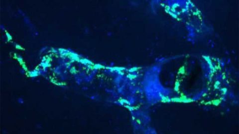New Window of Opportunity to Prevent Cardiovascular & Cerebrovascular Diseases