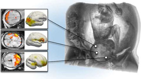 Researchers observe brain development in utero