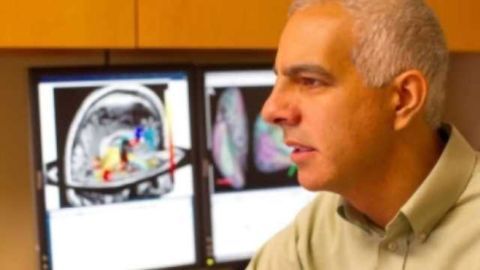 Study finds brain abnormalities in chronic fatigue patients
