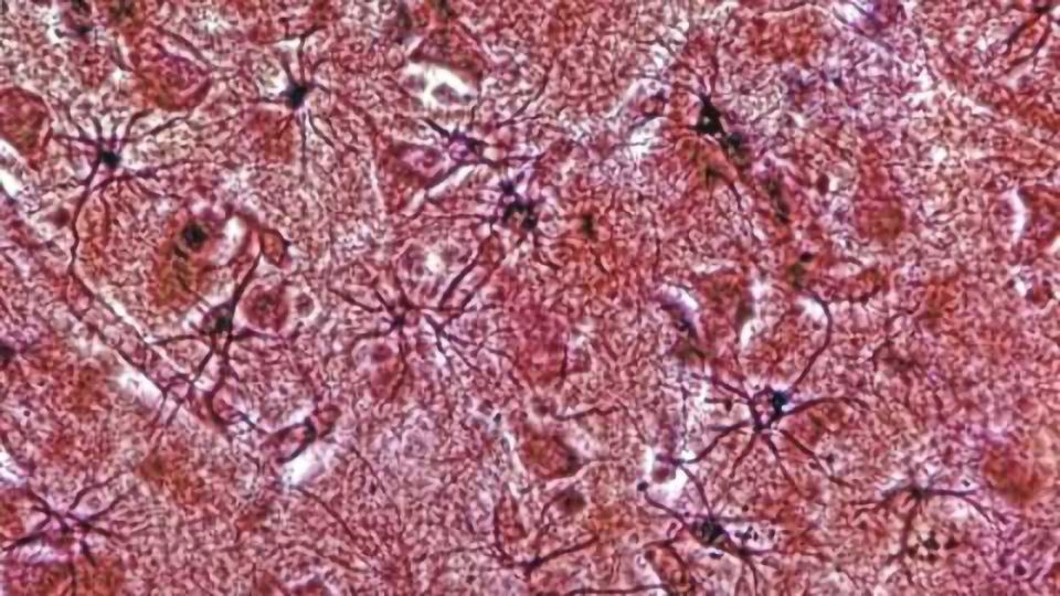 ALS: Renewing brain's aging support cells may help neurons survive content piece image