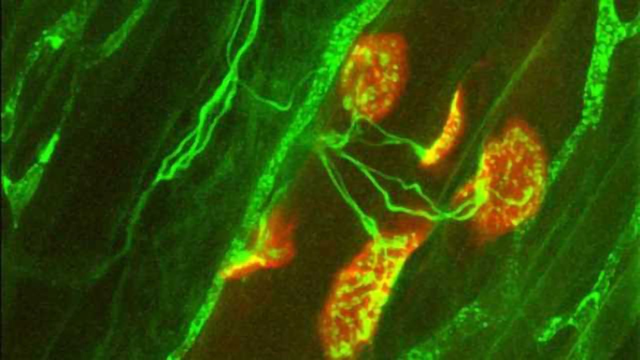 High prevalence of vitamin D deficiency across the board in neuromuscular disease