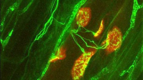 High prevalence of vitamin D deficiency across the board in neuromuscular disease