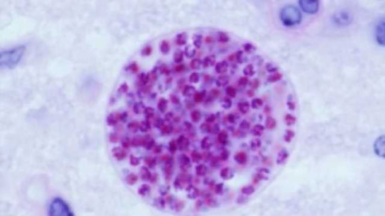 Epidemiological study investigates parasite-schizophrenia connection