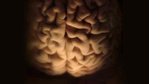 Brain anatomy differences between autistic & typically developing individuals are indistinguishable