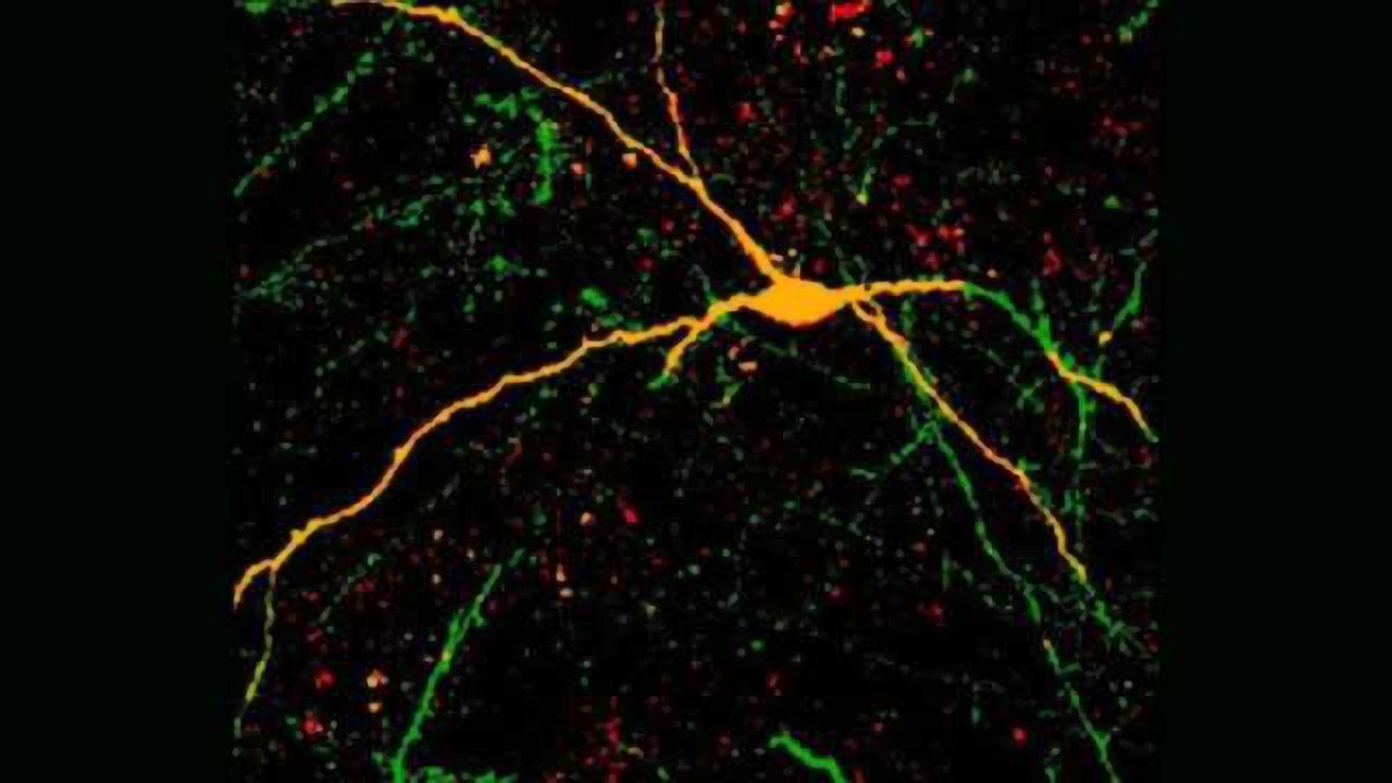 Human stem cell-derived neuron transplants reduce seizures in mice