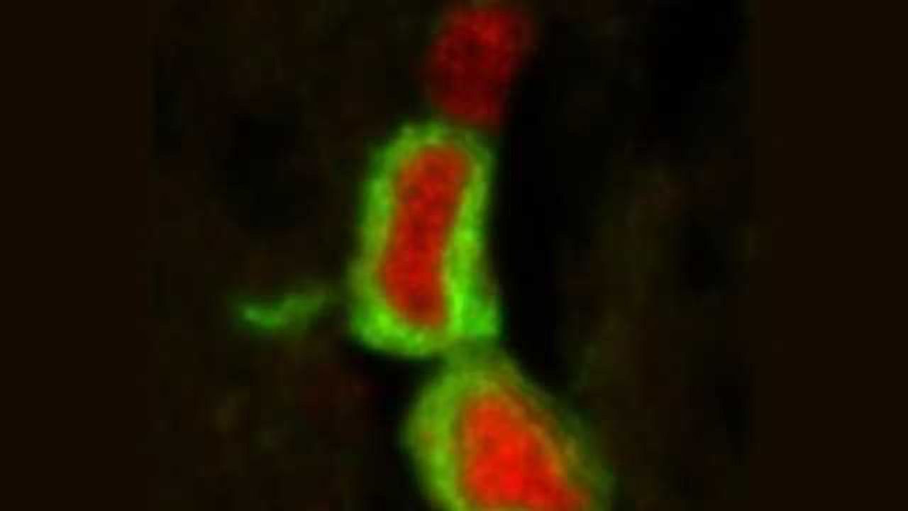 Research yields new knowledge about the human brain’s plasticity