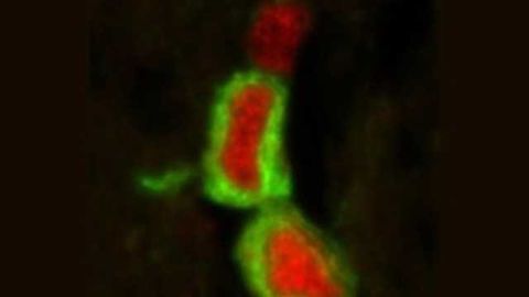 Research yields new knowledge about the human brain’s plasticity