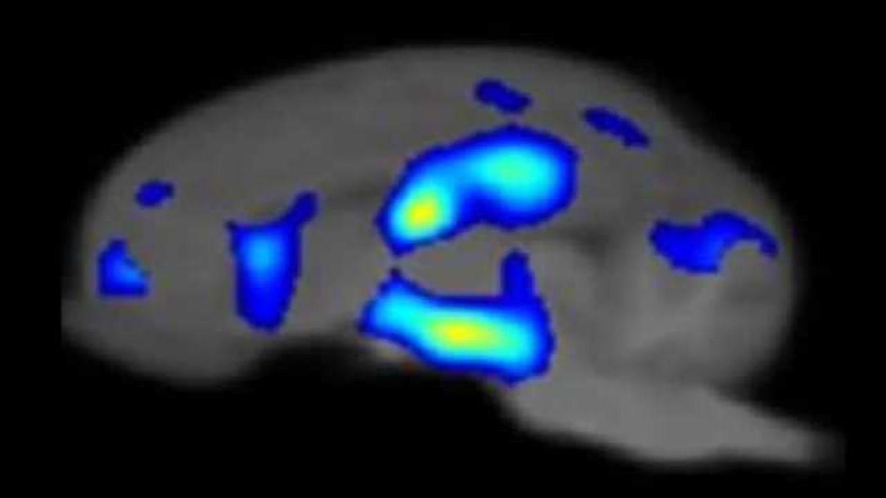 Piglet brain atlas new tool in understanding human infant brain development