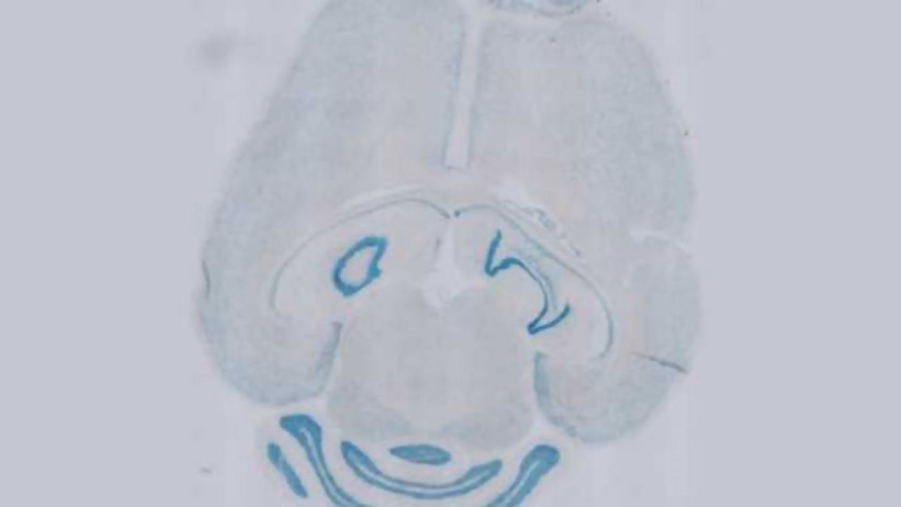 Study Blocks Multiple Sclerosis Relapses in Mice