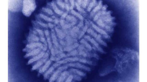 Researchers discover common chemotherapeutic agent reduces resistance to virus therapy in brain tumor patients