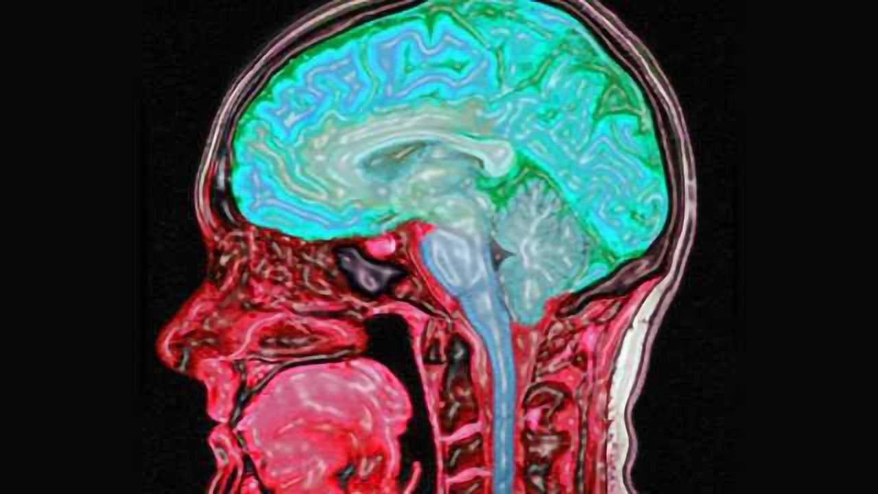 Do spinal cord injuries cause subsequent brain damage?
